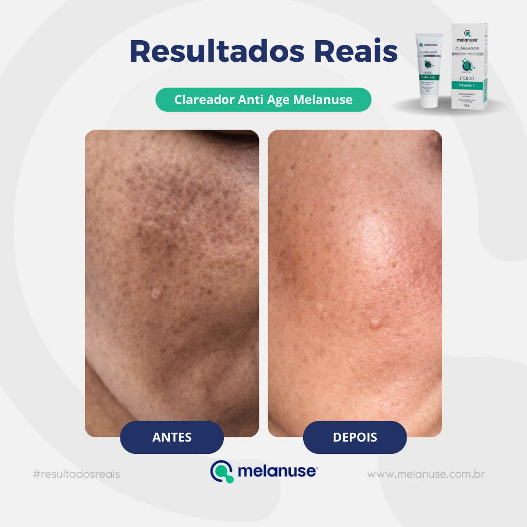 Clareador Anti Age