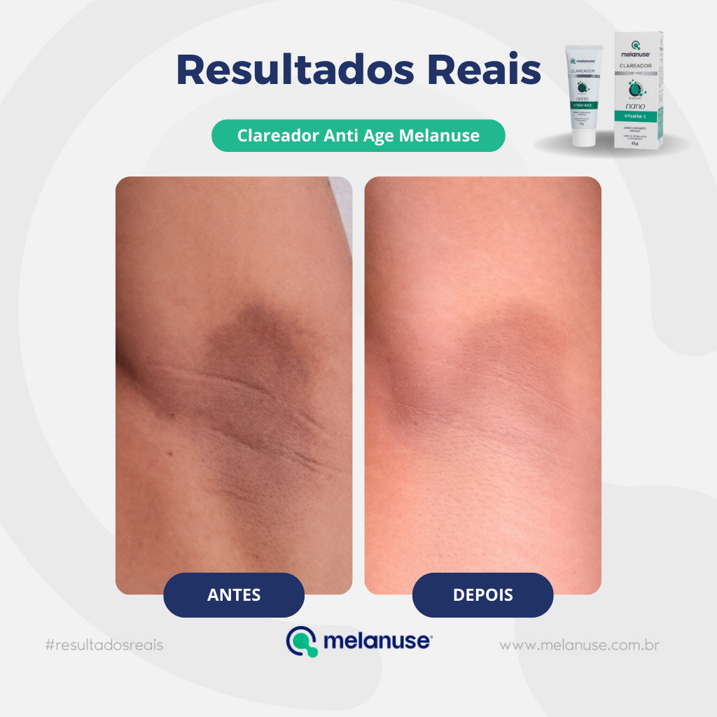 Clareador Anti Age