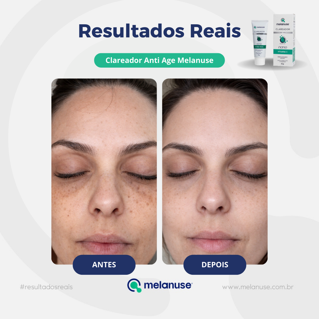 Clareador Anti Age